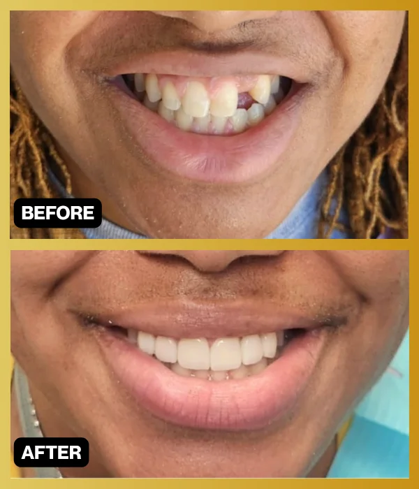 Before and after smile makeover case 1 from Dr. Ghasri’s practice